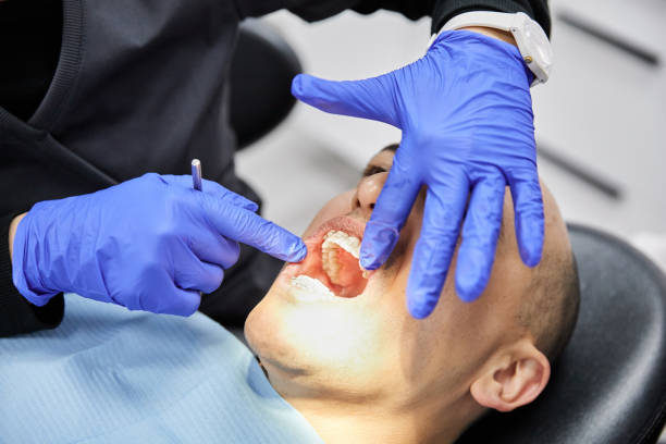 Best Emergency Wisdom Tooth Extraction in Wyandotte, MI